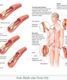 Lưu ý đặc biệt cho người bị tiểu đường