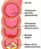 Những mẹo ăn uống giảm cholesterol