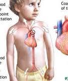 Nguyên nhân tim bẩm sinh ở trẻ em