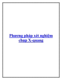 Phương pháp xét nghiệm chụp X-quang.