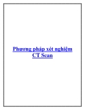 Phương pháp xét nghiệm CT Scan.