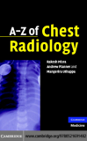A–Z of Chest Radiology