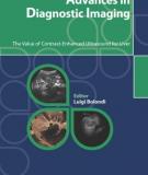 Advances in Diagnostic Imaging: The Value of Contrast-Enhanced Ultrasound for Liver