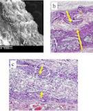 Applications of knitted mesh fabrication techniques to scaffolds for tissue engineering and regenerative medicine