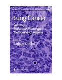 Lung Cancer Edited by Barbara Driscoll Volume I Molecular Pathology Methods and Reviews Lung Cancer Edited by Barbara Driscoll Volume I Molecular Pathology Methods and Reviews