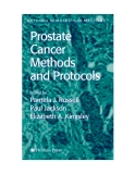 Prostate Cancer Methods and Protocols