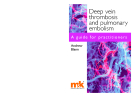Deep vein thrombosis and pulmonary embolism
