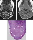 Kikuchi’ s Disease in Children: Clinical Manifestations and Imaging Features