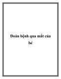 Đoán bệnh qua mắt của bé