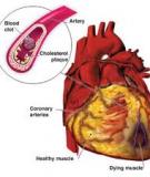 Cardiovascular Disease