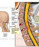 Nắn chỉnh cột sống chữa các bệnh thường gặp