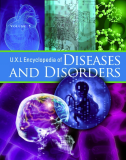 U•X•L Encyclopedia of Diseases and Disorders