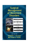 Surgical Management of Movement Disorders