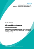 Advanced breast cancer:   This guideline updates and replaces NICE technology  appraisal guidance 62 (capecitabine), 54 (vinorelbine)  and 30 (taxanes) 