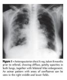 Smear microscopy and culture conversion rates among smear positive pulmonary tuberculosis patients by HIV status in Dar es Salaam, Tanzania