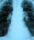 A rare case of pulmonary tuberculosis with simultaneous pulmonary and skin sarcoidosis: a case report