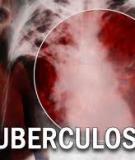 Tài liệu: DIAGNOSIS OF TUBERCULOSIS DISEASE