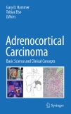 Adrenocortical Carcinoma Basic Science and Clinical Concepts