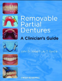 Removable Partial Dentures A Clinician’s Guide