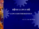 Bệnh Lupus đỏ - Lupus Erythematosus