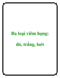 Ba loại viêm họng: đỏ, trắng, loét