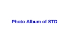 Photo Album of STD