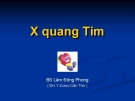 X quang tim - BS. lâm Đông Phong - ĐH Y dược Cần Thơ