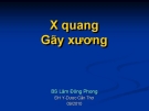 X quang gãy xương - BS. lâm Đông Phong - ĐH Y dược Cần Thơ