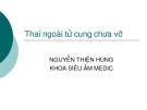 Thai ngoài tử cung chưa vỡ