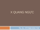 Bài giảng: X quang ngực