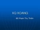 X quang xoang