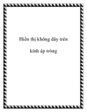 Hiển thị không dây trên kính áp tròng