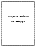 Cảnh giác cơn thiếu máu não thoáng qua