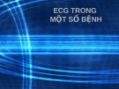 ECG trong một  số bệnh