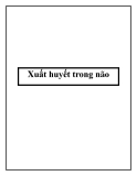 Xuất huyết trong não