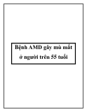 Bệnh AMD gây mù mắt ở người trên 55 tuổi