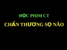 CT Chấn thương sọ não