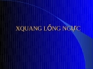 Xquang lồng ngực