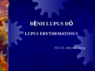 BỆNH LUPUS ĐỎ