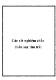 Các xét nghiệm chẩn đoán suy tim trái