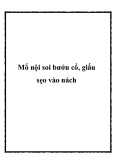 Mổ nội soi bướu cổ, giấu sẹo vào nách