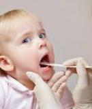 Những điều cần biết về chứng loét miệng ở các bé