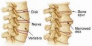 Phối hợp giúp đem lại hiệu quả tốt cho việc phòng ngừa loãng xương