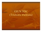 Bài giảng Giun tóc (Trichuris trichiura)