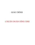 Giáo trình Chuẩn đoán hình ảnh - ĐH Y Huế