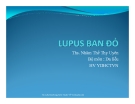 Bài giảng Lupus ban đỏ - Ths. Nhâm Thế Thy Uyên