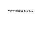 Bài giảng Vết thương bàn tay