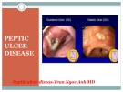 Lectures Peptic ulcer diseas - Trần Ngọc Anh