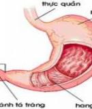 Viêm loét dạ dày và tá tràng
