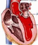 Quan điểm hiện nay trên thế giới về bệnh van tim